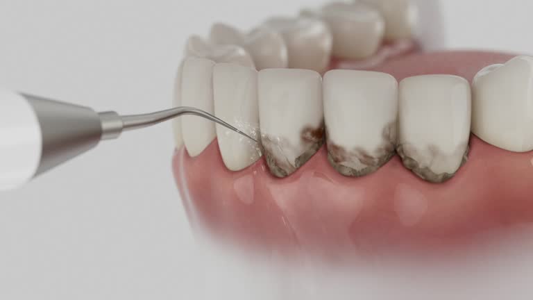 Reliable Dental Implants contractor in Palatka, FL by Smile Center Dentistry